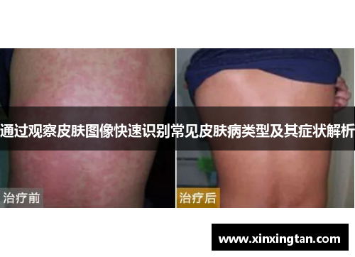 通过观察皮肤图像快速识别常见皮肤病类型及其症状解析
